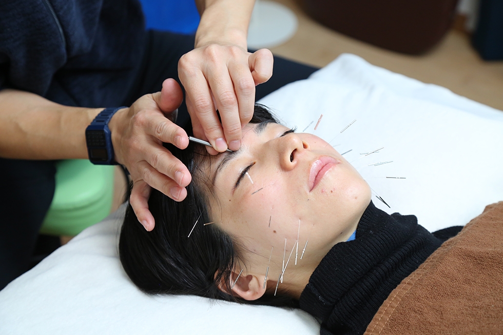 頭部や顔の鍼治療も可能。頭痛をはじめ、首、肩、腰、足、膝にお悩みの  方に効果的